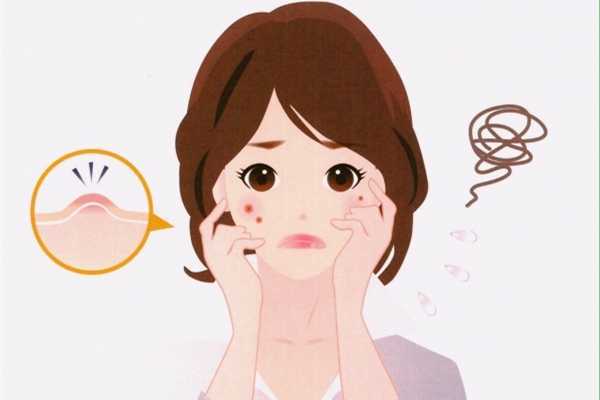 闭口会慢慢自己消失吗?闭口会变成痘痘吗 闭口会慢慢自己消失吗?闭口会变成痘痘吗