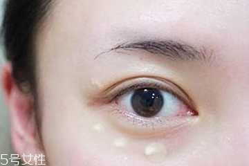 去黑眼圈用什么眼霜好