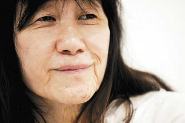 脸部松弛下垂怎么办？如何改善脸部松弛下垂