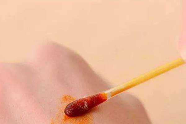 冻干粉能抹伤口吗 冻干粉能抹伤口吗