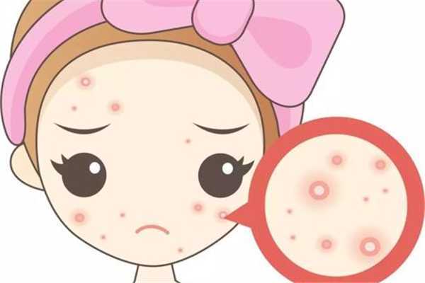 痘痘肌适合用什么洗面奶