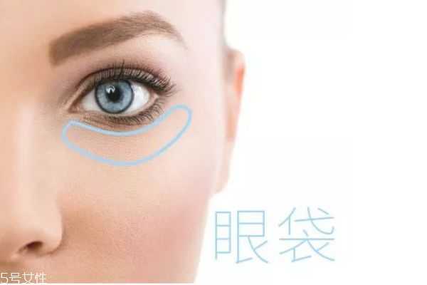 怎么样祛除眼袋