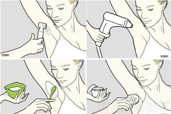 汗毛多怎么去除