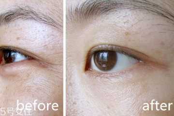 眼霜什么成分能去皱 预防皱纹从现在开始