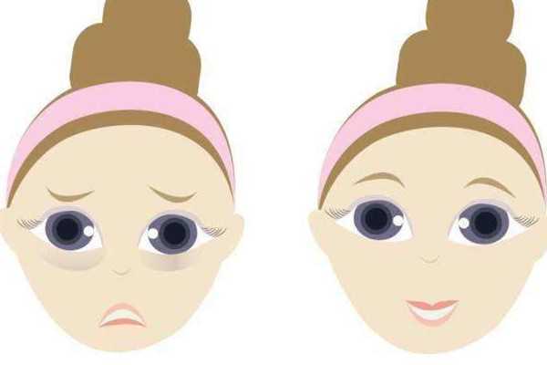 眼袋按摩可以消除吗 眼袋按摩可以消除吗