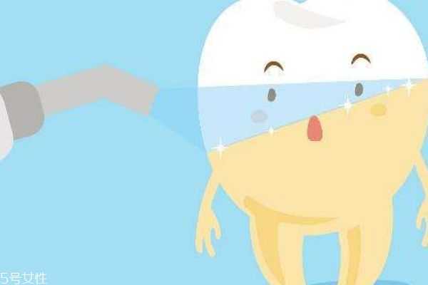 孕期能不能用洗牙粉 孕期能不能用洗牙粉