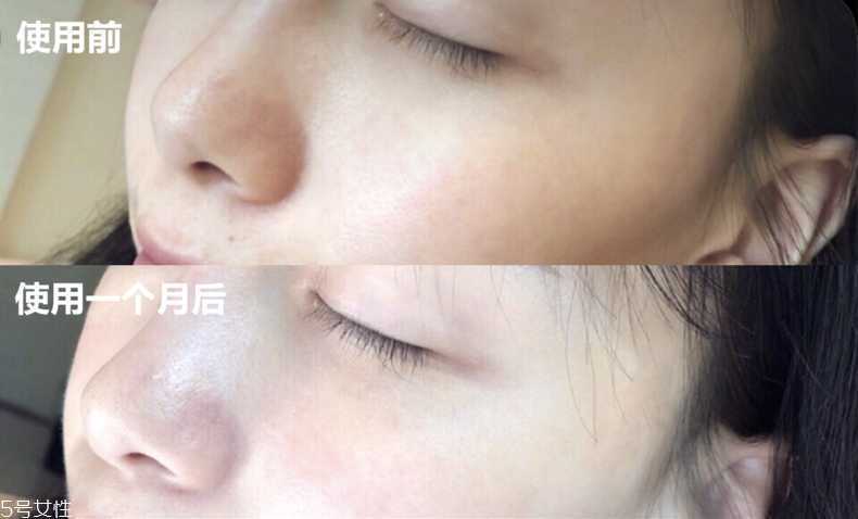 城野医生vc100冻干安瓶精华有效吗