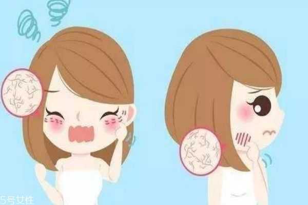 皮肤脱皮的原因有什么呢 为什么会皮肤脱皮呢