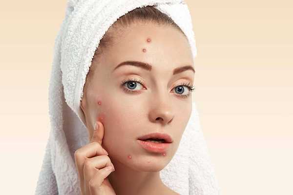 苏菲娜蓝蕾丝适用肌肤