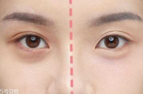 眼下遮瑕卡粉怎么办