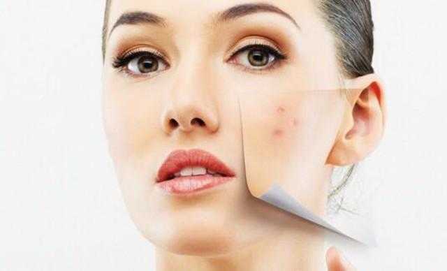 过度护肤的表现 过度护肤后怎么修复 过度护肤的表现 过度护肤后怎么修复