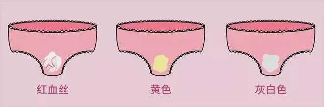 女生流出白白的东西怎么回事？看完这篇文章你就知道怎么回事了