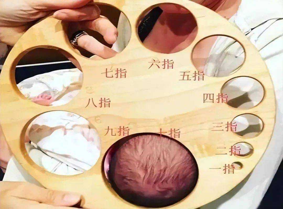 顺产中的“开十指”到底是多大? 顺产中的“开十指”到底是多大?