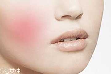 舒缓敏感用什么面膜好