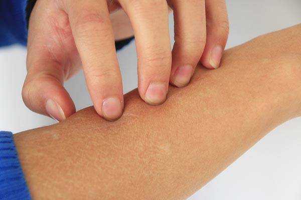 皮肤上莫名长出来的“小疙瘩”，是疾病信号吗？能不能用手抠掉？ 