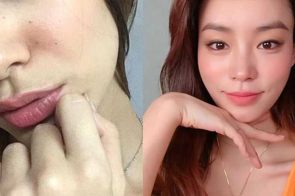 毛孔粗大什么原因引起的