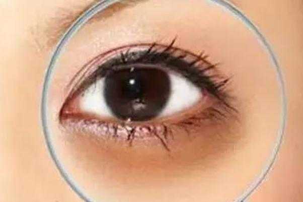 黑眼圈很重怎么去除 黑眼圈为什么很重