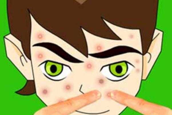 青春痘可以自愈吗？可以用洗面奶吗