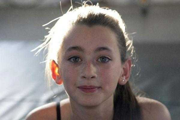 雀斑会变成黄褐斑吗?雀斑会一直长吗 雀斑会变成黄褐斑吗?雀斑会一直长吗