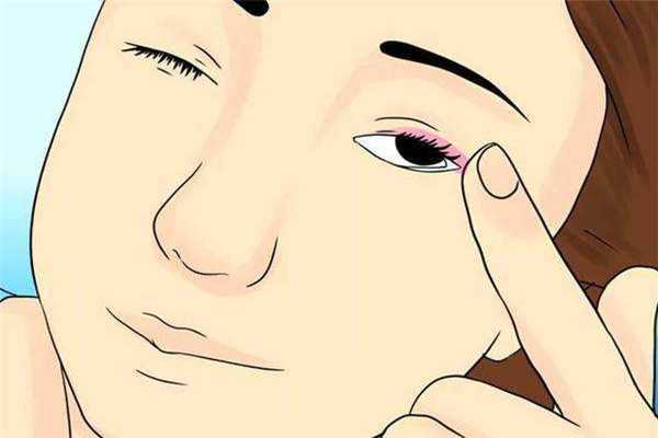 脂肪粒能用甘油去除吗 脂肪粒发痒是怎么回事