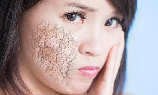 冬季皮肤干燥是怎么回事？皮肤干燥要怎么缓解推荐5大妙招