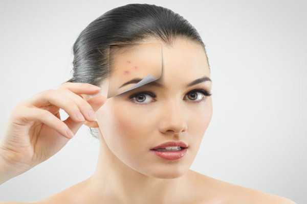 有粉刺可以化妆吗？有粉刺可以刷酸吗