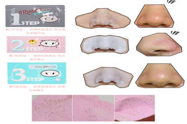 黑头贴多久用一次 黑头贴效果好吗