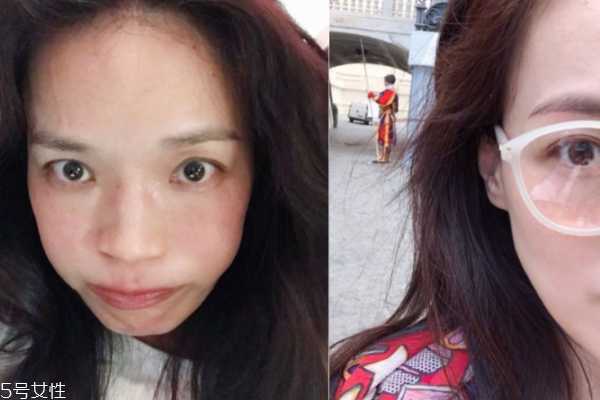 敏感肌怎样保养