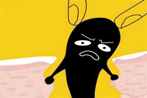 黑头是怎么产生的?黑头可以挤吗 黑头是怎么产生的?黑头可以挤吗