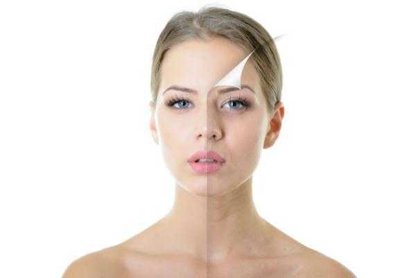 刷酸有什么好处和坏处?刷酸有刺痛感正常吗 刷酸有什么好处和坏处?刷酸有刺痛感正常吗