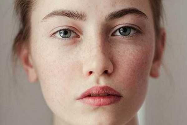 色斑的形成原因是什么 色斑的形成原因是什么