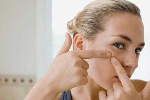 粉刺可以挑出来吗？粉刺可以自己挤吗