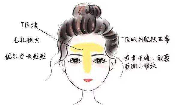 混干皮和混油皮区别是什么 混干皮和混油皮区别是什么