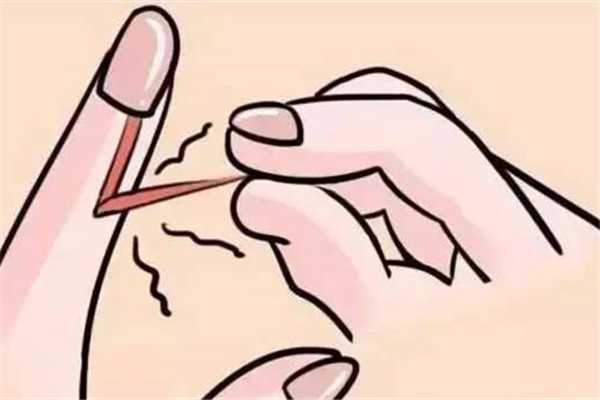 手长倒刺是什么原因造成的 手长倒刺是什么原因造成的