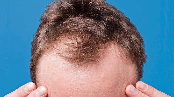 头发没吹干睡觉会怎样？