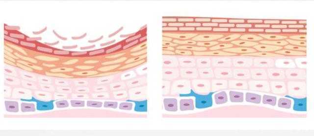 olay小白瓶和科颜氏淡斑精华哪个好用