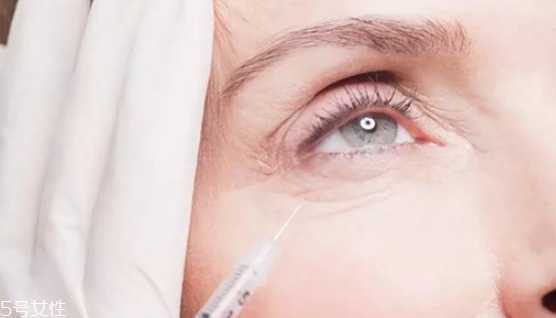 去眼部皱纹最好的方法
