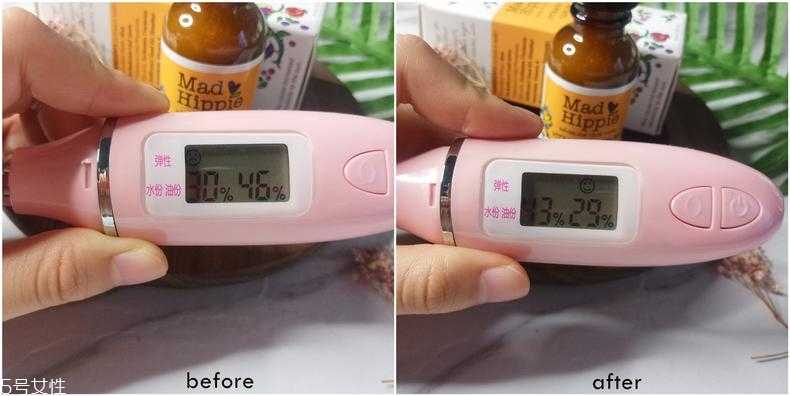 mad hippie维a精华适合什么肤质