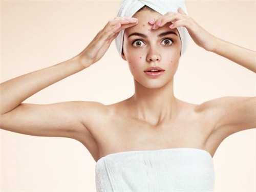 脸上长青春痘怎么办