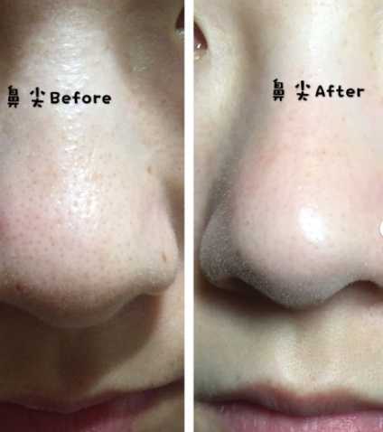 白泥面膜的正确使用方法 白泥面膜的正确使用方法