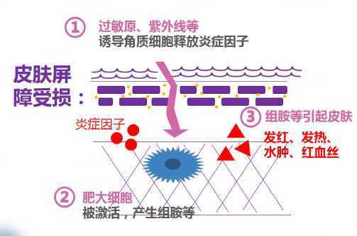 皮肤屏障修复要多长时间 皮肤屏障修复要多长时间