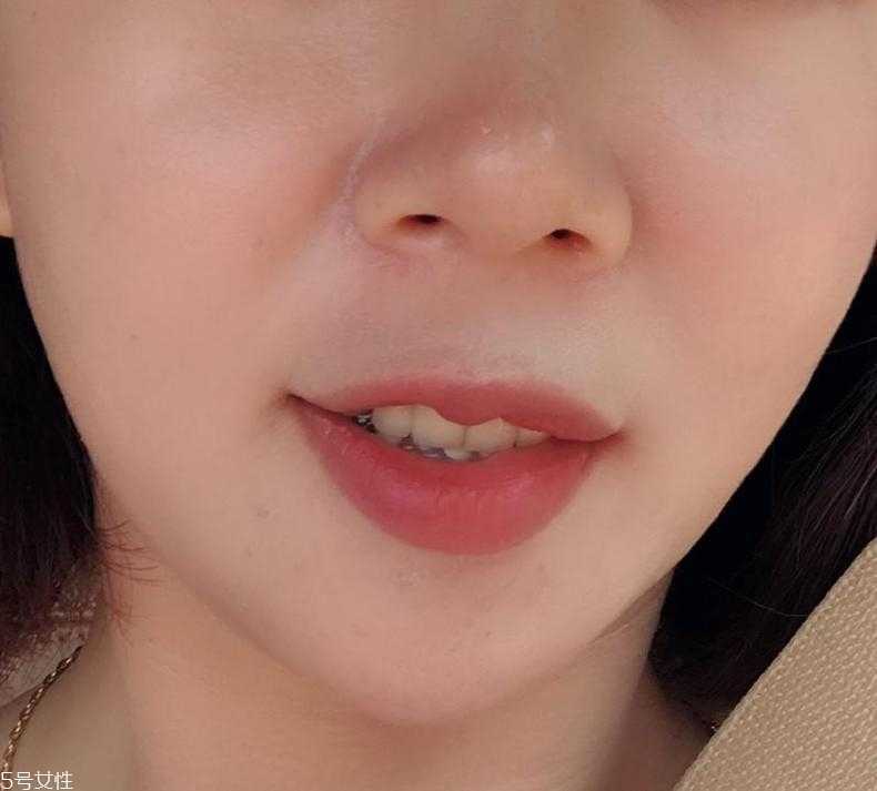 赛贝格精华使用方法