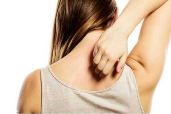 秋季皮肤干燥过敏痒怎么办