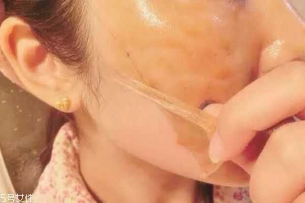 撕拉面膜后可以敷面膜吗 用完撕拉要不要敷面膜