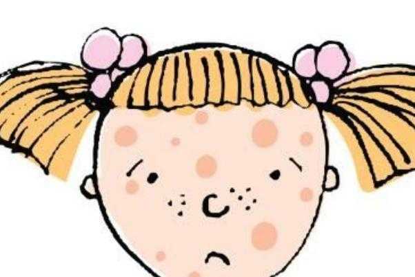 青春痘有哪几种类型 青春痘有脓包怎么办