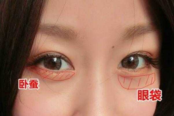 卧蚕和眼袋有什么区别 卧蚕和眼袋有什么区别