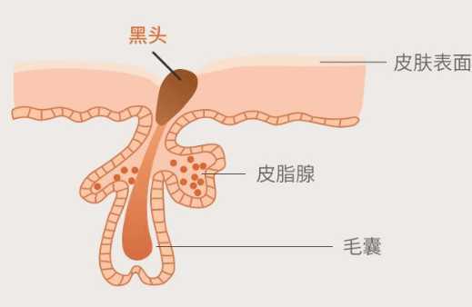 黑头和粉刺是怎么形成的 黑头和粉刺是怎么形成的
