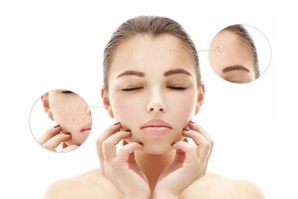 收缩毛孔可以用芦荟胶吗