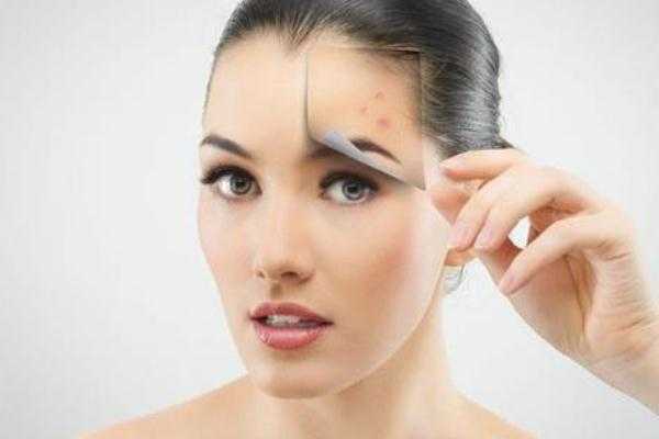 粉刺有硬块但是挤不出来怎么办