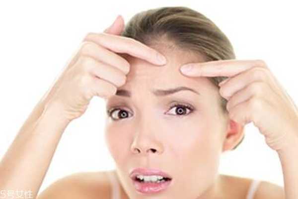 挤痘痘工具用什么好